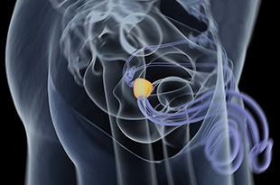 Differenze tra prostatite e tumore alla prostata